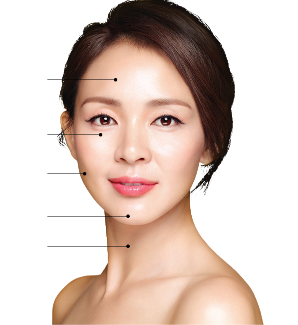 울쎄라 쿼트로 시술부위