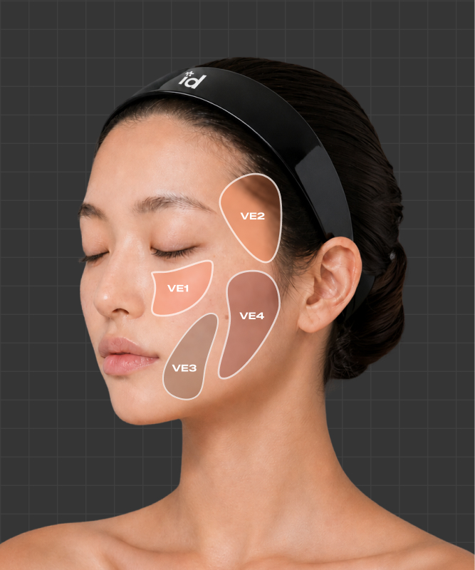 Vector Lifting 시술 부위