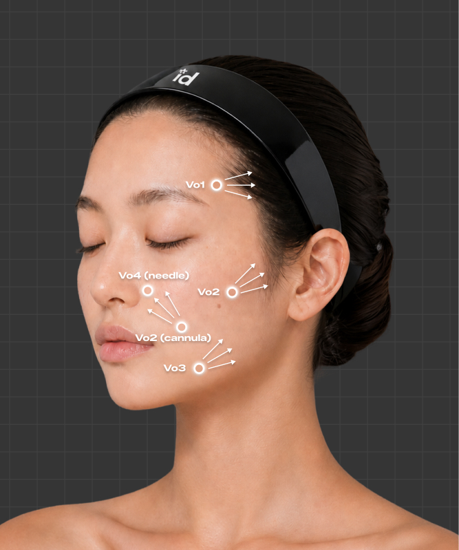 Volume Lifting 시술 부위