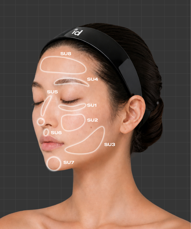 Surface Lifting 시술 부위