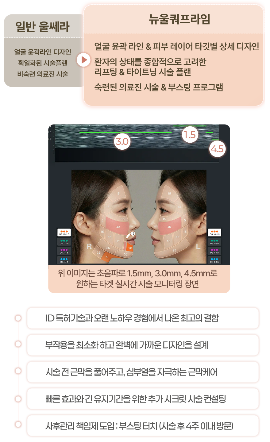 일반 울쎄라 > 뉴울쿼 프라임