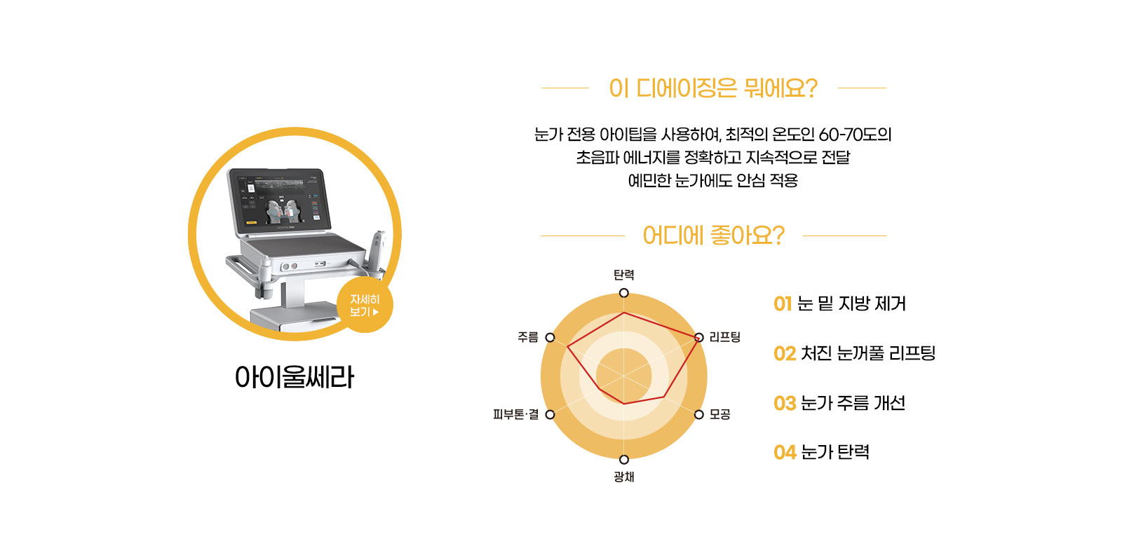 아이울쎄라