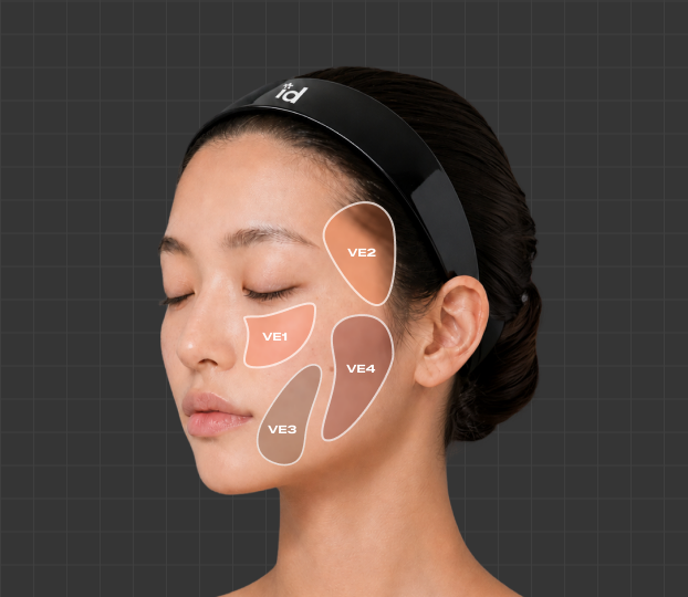 Vector Lifting 시술 부위
