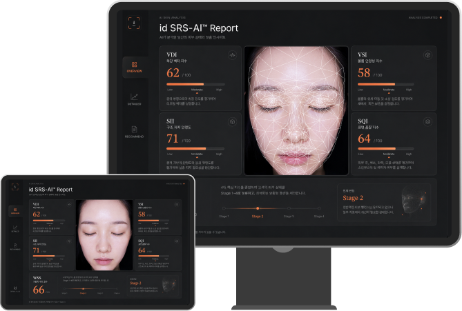 id SRS-AI Report 모니터·태블릿 화면