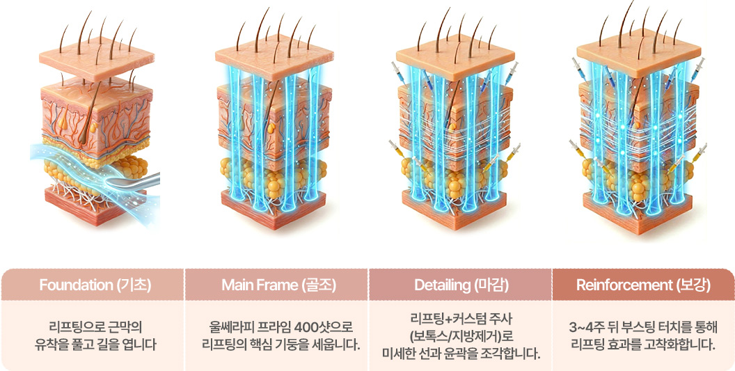 기초 리프팅으로 근막의 유착을 풀고 길을 엽니다 / 골조 400샷 리프팅의 핵심 기둥을 세웁니다 / 마감 리프팅 +커스텀 주사 (보톡스/지방제거)로 미세한 선과 윤곽을 조각합니다. / 보강 3~4주 부스팅 터치를 통해 리프팅 효과를 고착화합니다