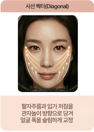 사선벡터 팔자주름과 입가처짐을 관자놀이 방향으로 당겨 얼굴 폭을 슬림하게 교정