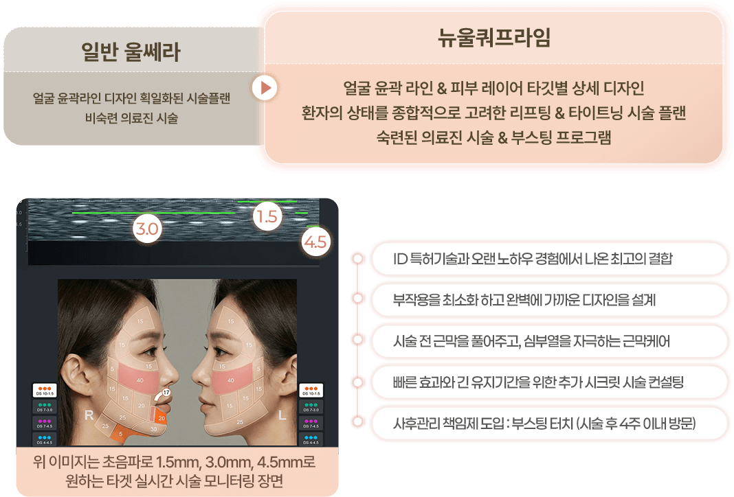 일반 울쎄라 > 뉴울쿼 프라임