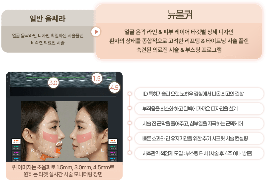 일반 울쎄라 > 뉴울쿼 프라임